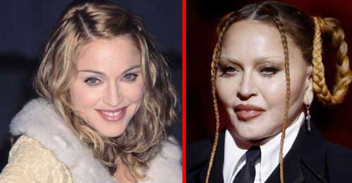 Madonna Looks Unrecognizable At the Grammys, Leaving Fans Shocked And ...